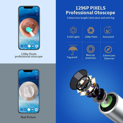 NE3™ EarWax Removal Kit with HD Camera