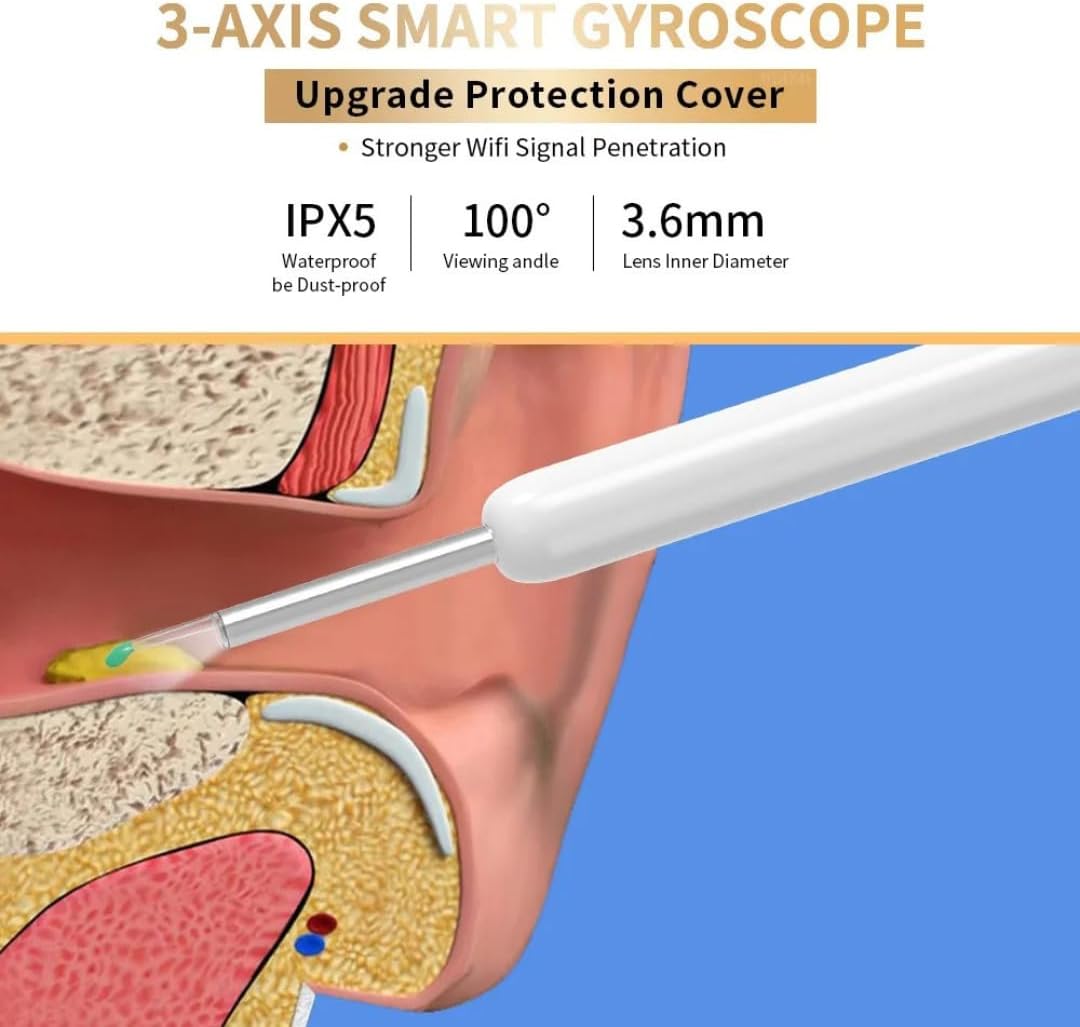 NE3™ EarWax Removal Kit with HD Camera