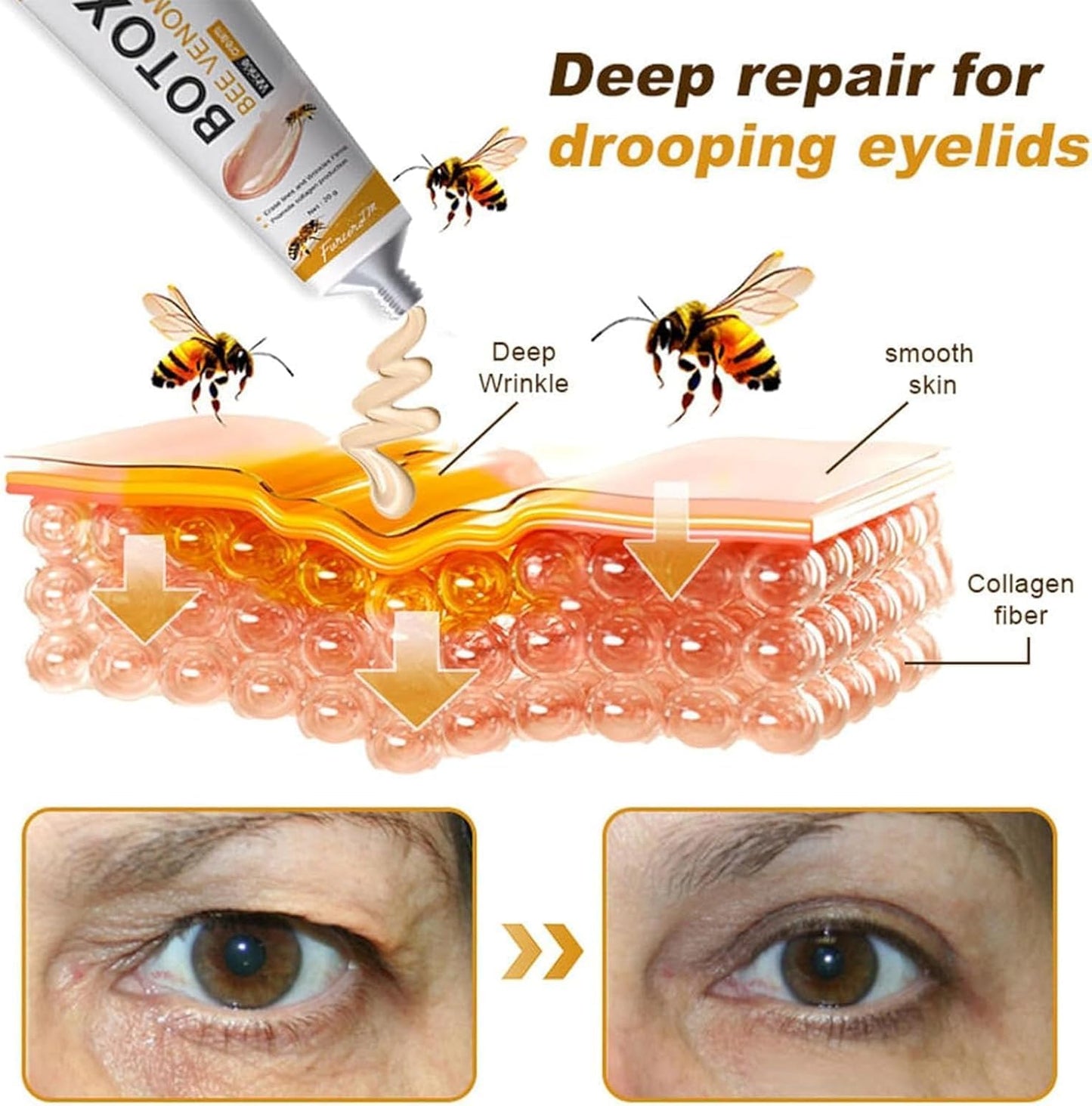 Botox™ Bee Venom Wrinkle Removal Cream