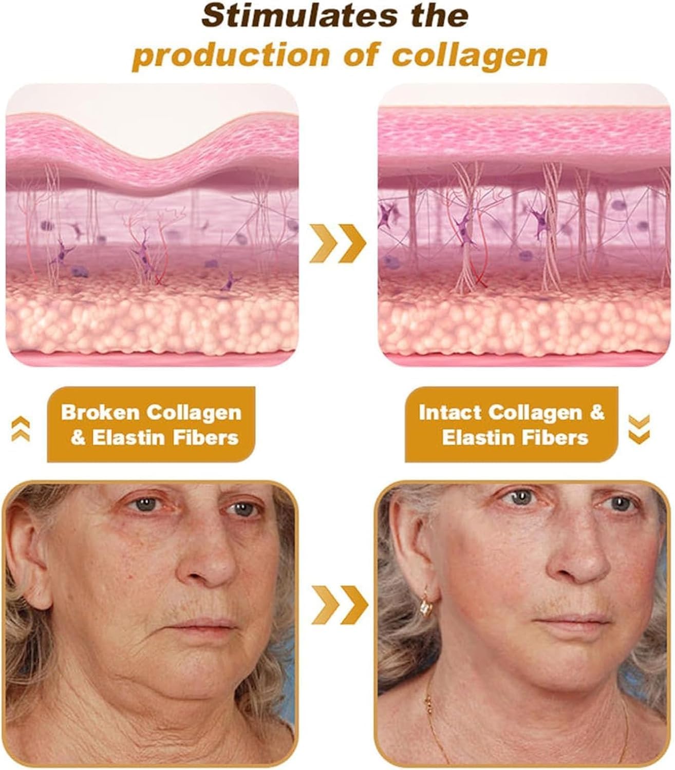 Botox™ Bee Venom Wrinkle Removal Cream